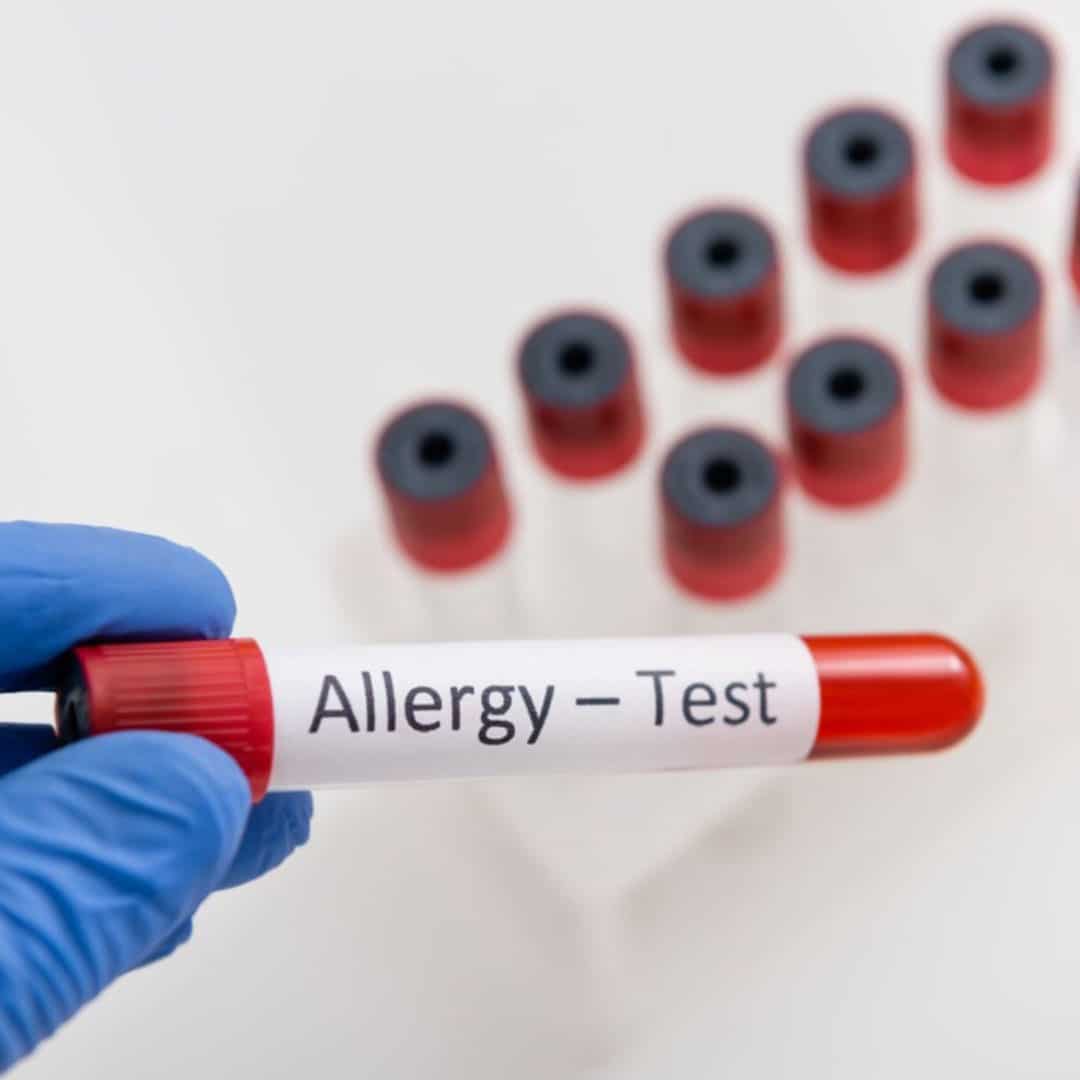 San Antonio Breathe Free Allergy Testing Blood Work