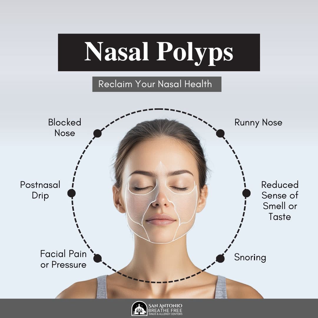 San Antonio Breathe Free Nasal Polyps Symptoms